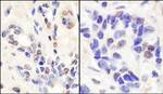BRCA1 Antibody in Immunohistochemistry (IHC)