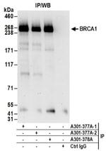 BRCA1 Antibody in Western Blot (WB)