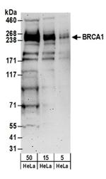 BRCA1 Antibody in Western Blot (WB)