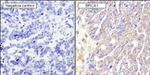 BRCA1 Antibody in Immunohistochemistry (Paraffin) (IHC (P))