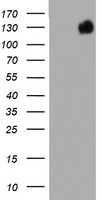 BRCA1 Antibody in Western Blot (WB)