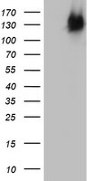 BRCA1 Antibody in Western Blot (WB)