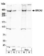 BRCA2 Antibody in Western Blot (WB)