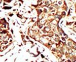 BRD3 Antibody in Immunohistochemistry (IHC)