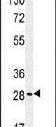 BRMS1L Antibody in Western Blot (WB)
