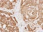 BRMS1 Antibody in Immunohistochemistry (IHC)