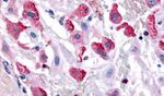 Bombesin Receptor 3 Antibody in Immunohistochemistry (Paraffin) (IHC (P))