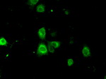 BSG Antibody in Immunocytochemistry (ICC/IF)