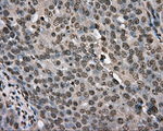 BSG Antibody in Immunohistochemistry (Paraffin) (IHC (P))