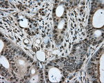BSG Antibody in Immunohistochemistry (Paraffin) (IHC (P))