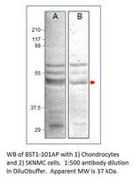 Bone marrow stromal cell antigen 1 Polyclonal Antibody