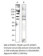 BTBD7 Polyclonal Antibody