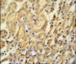 BTBD9 Antibody in Immunohistochemistry (IHC)