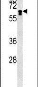 BTBD9 Antibody in Western Blot (WB)