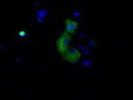 BTK Antibody in Immunocytochemistry (ICC/IF)