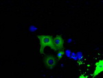 BTK Antibody in Immunocytochemistry (ICC/IF)
