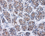 BTK Antibody in Immunohistochemistry (Paraffin) (IHC (P))