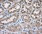 BTK Antibody in Immunohistochemistry (Paraffin) (IHC (P))