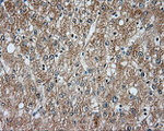 BTK Antibody in Immunohistochemistry (Paraffin) (IHC (P))
