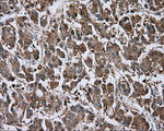 BTK Antibody in Immunohistochemistry (Paraffin) (IHC (P))