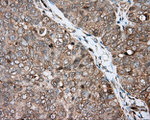 BTK Antibody in Immunohistochemistry (Paraffin) (IHC (P))