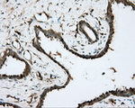 BTK Antibody in Immunohistochemistry (Paraffin) (IHC (P))
