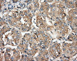 BTK Antibody in Immunohistochemistry (Paraffin) (IHC (P))