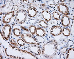 BTK Antibody in Immunohistochemistry (Paraffin) (IHC (P))