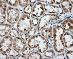 BTK Antibody in Immunohistochemistry (Paraffin) (IHC (P))