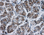 BTK Antibody in Immunohistochemistry (Paraffin) (IHC (P))