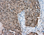 BTK Antibody in Immunohistochemistry (Paraffin) (IHC (P))