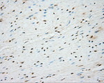 BTK Antibody in Immunohistochemistry (Paraffin) (IHC (P))