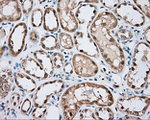 BTK Antibody in Immunohistochemistry (Paraffin) (IHC (P))