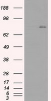 BTK Antibody in Western Blot (WB)