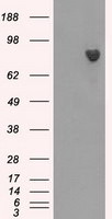 BTK Antibody in Western Blot (WB)