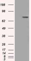 BTK Antibody in Western Blot (WB)