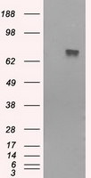 BTK Antibody in Western Blot (WB)