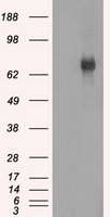 BTK Antibody in Western Blot (WB)