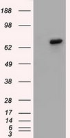 BTK Antibody in Western Blot (WB)