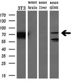 BTK Antibody in Western Blot (WB)