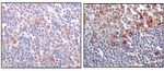 Btk Antibody in Immunohistochemistry (Paraffin) (IHC (P))