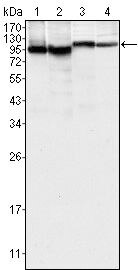Btk Antibody in Western Blot (WB)