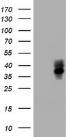 BTLA Antibody in Western Blot (WB)