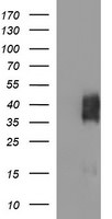 BTLA Antibody in Western Blot (WB)