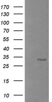 BTLA Antibody in Western Blot (WB)
