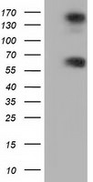 BTN1A1 Antibody in Western Blot (WB)