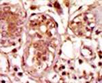 Bub1 Antibody in Immunohistochemistry (IHC)