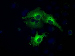 BUB1B Antibody in Immunocytochemistry (ICC/IF)