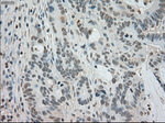 BUB1B Antibody in Immunohistochemistry (Paraffin) (IHC (P))