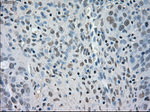 BUB1B Antibody in Immunohistochemistry (Paraffin) (IHC (P))